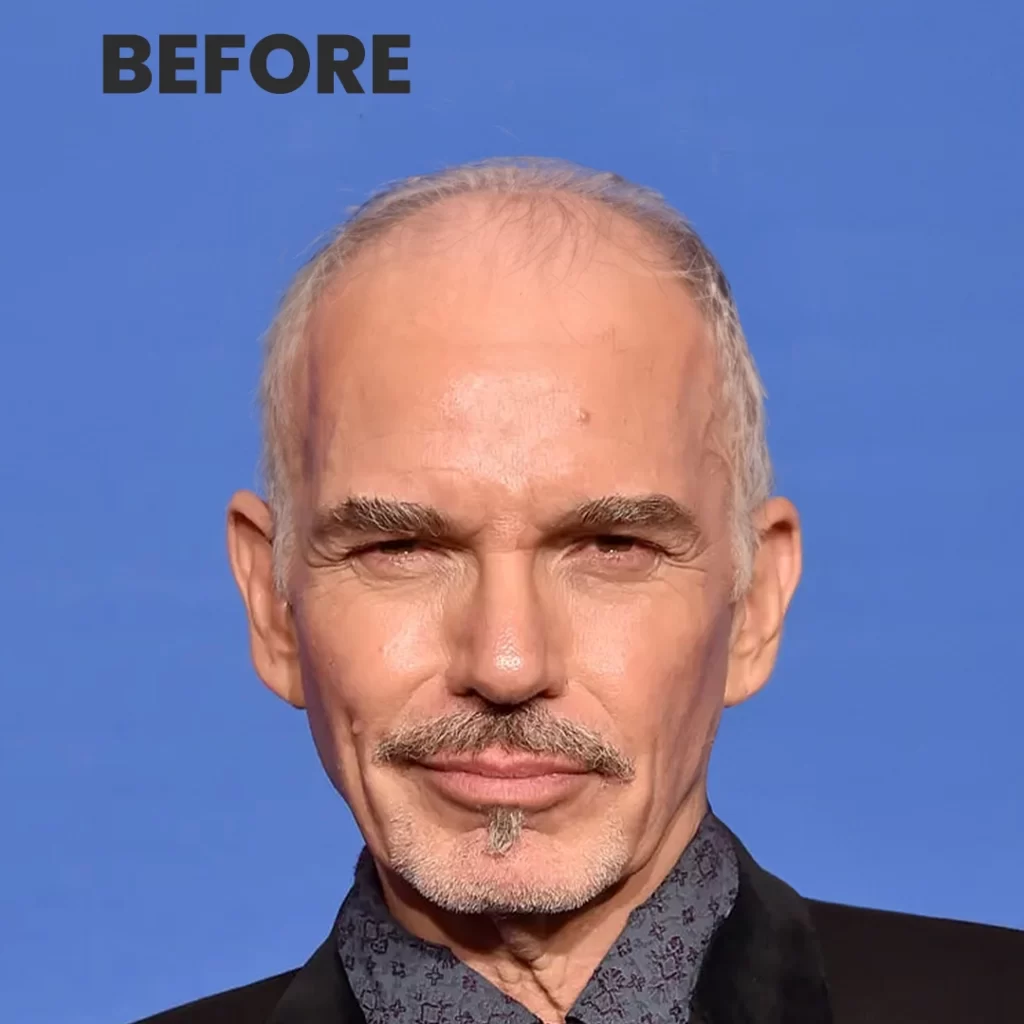 Post Image