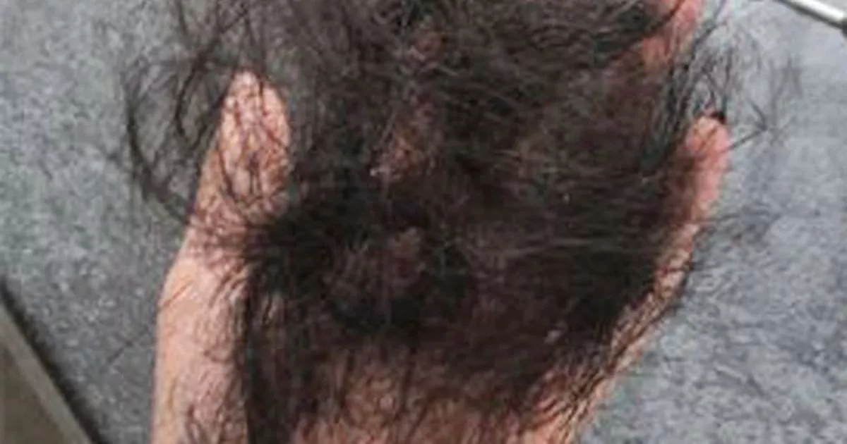 Post Image