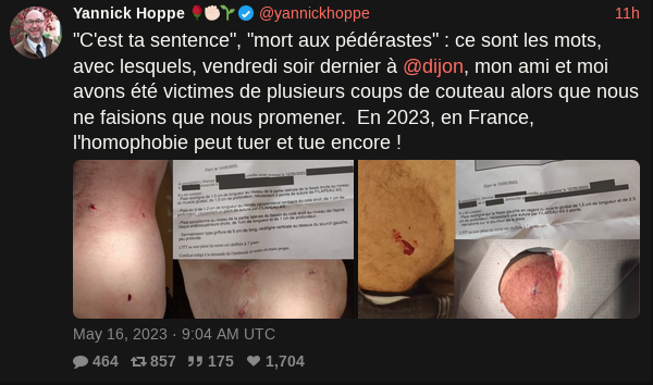 Agression Au Lac Kir À Dijon: Trois Victimes, Enquête En Cours Agression Au Lac Kir À Dijon: Trois Victimes, Enquête En Cours