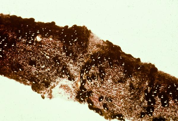 Apple Crop Losses: Rosy Apple Aphid Infestation Impacts Harvest Apple Crop Losses: Rosy Apple Aphid Infestation Impacts Harvest