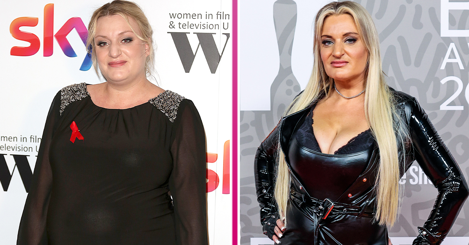 Daisy May Cooper Opens Up: Weight Loss, Lip Fillers, And Body Image Daisy May Cooper Opens Up: Weight Loss, Lip Fillers, And Body Image