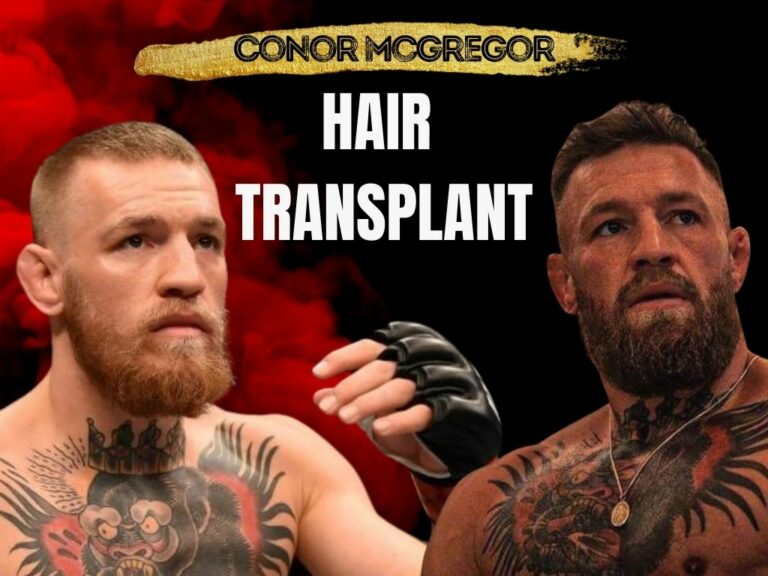 Fox News Coverage Of Conor McGregor: A Critical Analysis Fox News Coverage Of Conor McGregor: A Critical Analysis