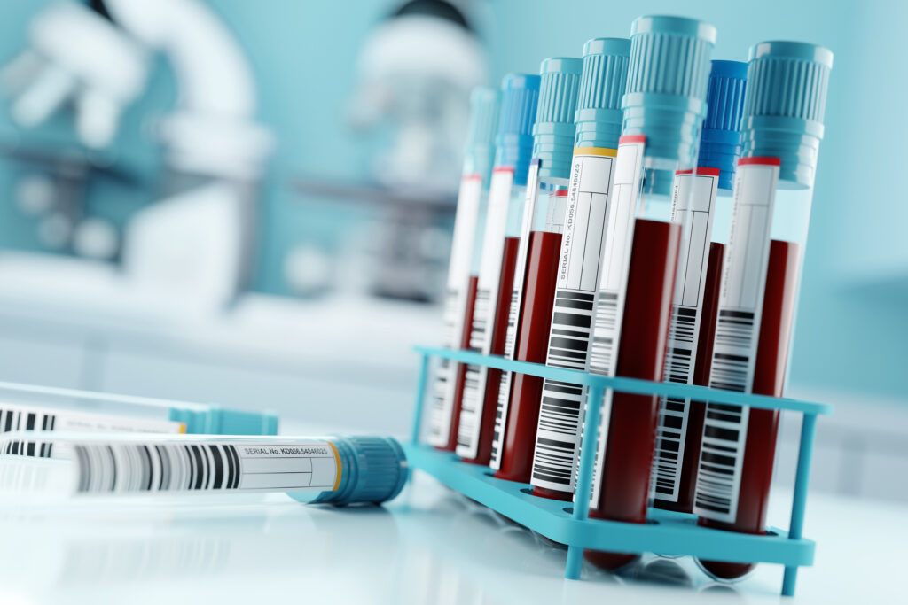 Lab Owner's Guilty Plea: Faked COVID Test Results During Pandemic Lab Owner's Guilty Plea: Faked COVID Test Results During Pandemic