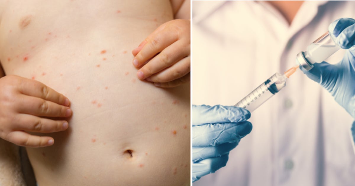 Measles Outbreak Prompts School Quarantine Of Unvaccinated Children In North Dakota Measles Outbreak Prompts School Quarantine Of Unvaccinated Children In North Dakota