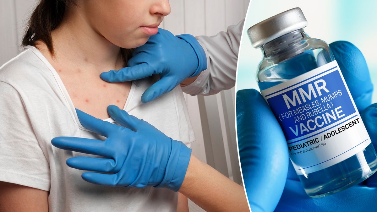 The Measles Outbreak: Spurring Action On US Vaccine Watchdog Efforts The Measles Outbreak: Spurring Action On US Vaccine Watchdog Efforts