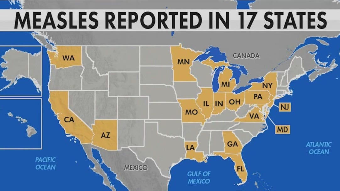 The Return Of Measles: Examining The Kansas Outbreak