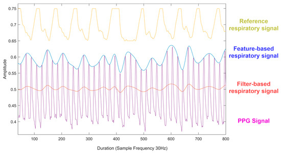 Unraveling Kawasaki Disease: Evidence Points To A Novel Respiratory Virus Unraveling Kawasaki Disease: Evidence Points To A Novel Respiratory Virus