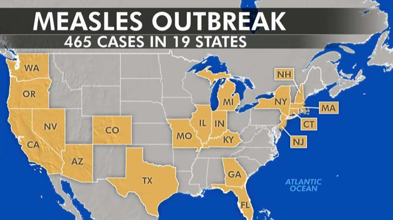 US Vaccine Watchdog Effort Launched Amidst Measles Outbreak Surge US Vaccine Watchdog Effort Launched Amidst Measles Outbreak Surge